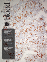 Blood journal